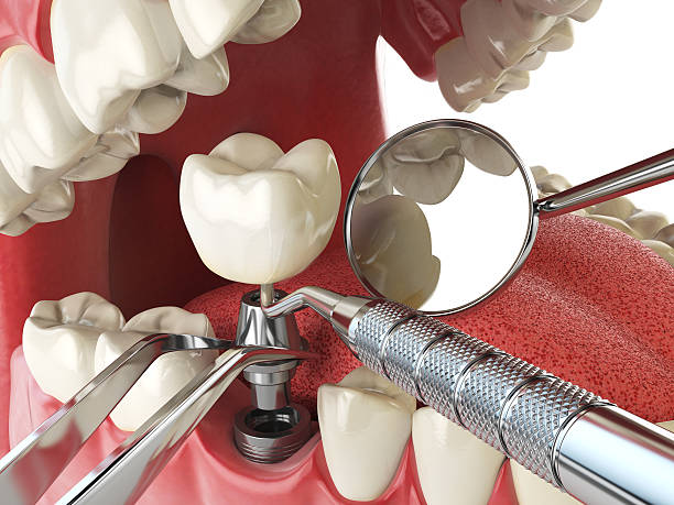 Best Tooth Infection Emergency Dentist  in Kensington, NY